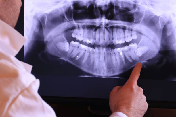 Best Emergency Denture Repair in Bargaintown, NJ